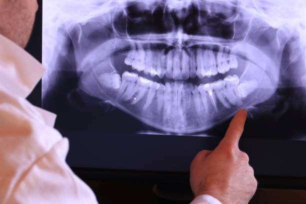 Best Orthodontic Emergency Dentist in Comer, GA