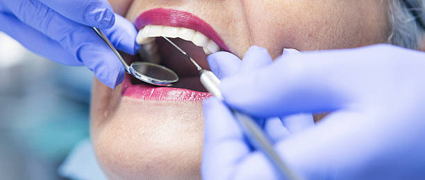 Best Emergency Dentist for Knocked-Out Tooth in Comer, GA